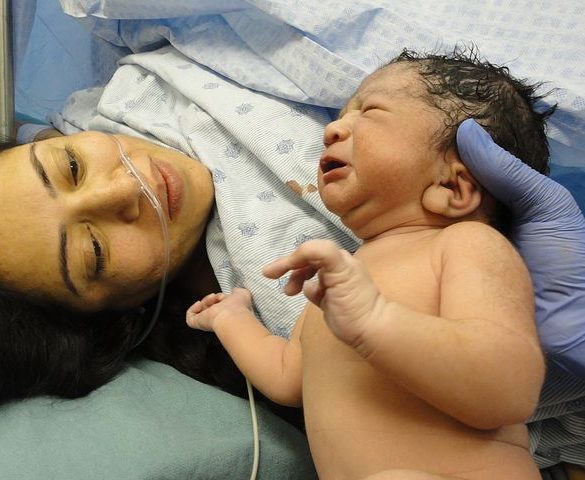 A guide to recovering from a c-section