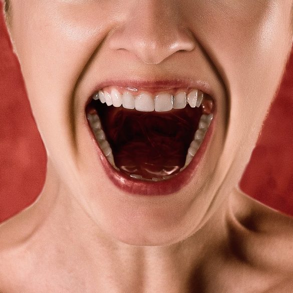 Getting Braces As An Adult