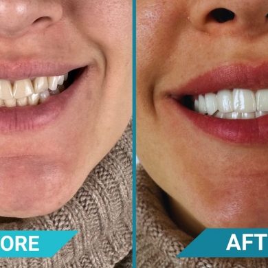 CLINIQUEPLUS Leads the Charge in Revolutionary Dental Treatments