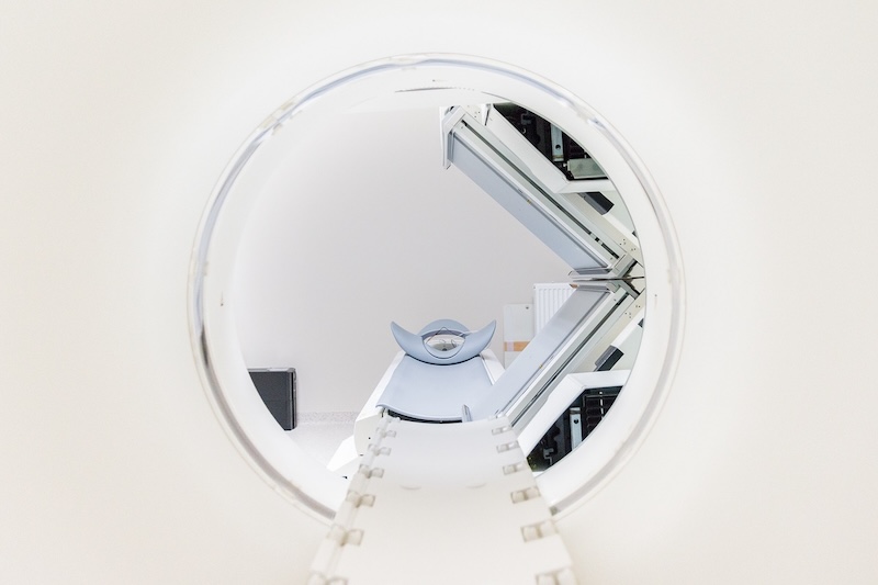 Preparing for an MRI: Step-by-Step Guide
