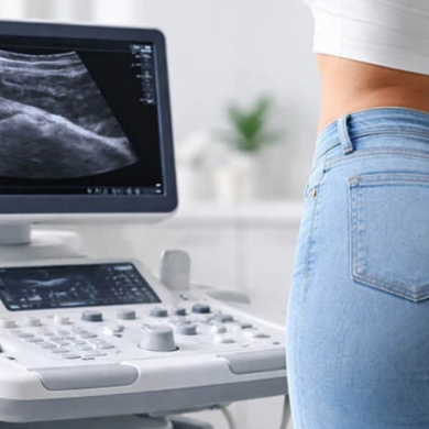 Smart BBL with Ultrasound: How It Works-Explained for Patients