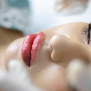 Which Lasts Longer, Facial Fat Transfer or Fillers?
