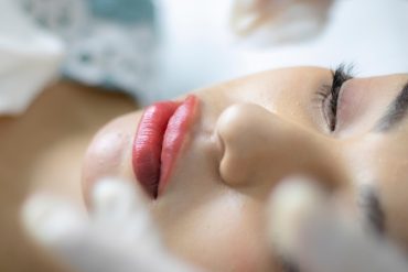 Which Lasts Longer, Facial Fat Transfer or Fillers?
